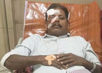 തെങ്ങിനു മുകളിൽ നിന്ന് കുരങ്ങ് പരിക്ക് പറിച്ചെറിഞ്ഞു; മുഖത്ത് കൊണ്ട് കർഷകന് ഗുരുതര പരിക്ക്; അപകടം തെങ്ങിൻതോപ്പിൽ പണിയെടുക്കുന്നതിനിടെ