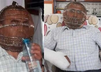 പുകവലി നിർത്താൻ തല കൂട്ടിലടച്ചു..!!! താക്കോൽ ഭാര്യയുടെ കയ്യിൽ…!! 26 വർഷമായുള്ള പുകവലി നിർത്താൻ യുവാവ് ചെയ്തത്…