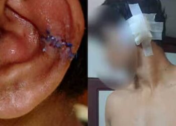 ജൂനിയർ വിദ്യാർഥികളുടെ ആക്രമണത്തിൽ പ്ലസ്ടു വിദ്യാർഥിയുടെ ചെവിയുടെ ഒരു ഭാഗം മുറിഞ്ഞുപോയി, ആക്രമണത്തിൻറെ ദൃശ്യങ്ങളുണ്ടെങ്കിൽ റീലാക്കിയിടണമെന്ന ശബ്ദ സന്ദേശം പുറത്ത്, മർദ്ദന വിവരം വാർഡനും അധ്യാപകരും ചേർന്ന് മറച്ചുവച്ച് ചികിത്സ വൈകിപ്പിച്ചതായി പരാതി