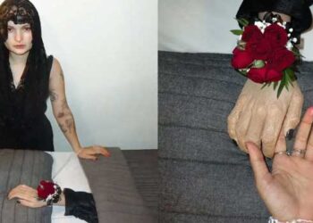 ഒരിക്കൽ അവൾക്കെല്ലാമായിരുന്നു ആ കൈ…അവൾ അഹങ്കരിച്ചിരുന്നു ആ കയ്യുടെ പിൻബലത്തിൽ… എന്നാൽ ഇന്ന് ക്യാൻസർ അവളെ ആ കയ്യിൽ നിന്നും അടർത്തിമാറ്റി… ക്യാൻസർ ബാധിച്ച് മുറിച്ചുമാറ്റേണ്ടി വന്ന കൈയുടെ സംസ്കാരം നടത്തി സോഷ്യൽ മീഡിയ ഇൻഫ്‌ളുവൻസർ