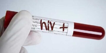 യുവാക്കൾക്ക് എയ്ഡ്സ് സ്ഥിരീകരിച്ചത് ആരോഗ്യ വകുപ്പ് ജയിലിൽ നടത്തിയ പരിശോധനയിൽ, രോ​ഗബാധിതർ വളാഞ്ചേരി ലഹരി വിതരണ കേന്ദ്രവുമായി ബന്ധപ്പെട്ട് പ്രവർത്തിച്ചവർ