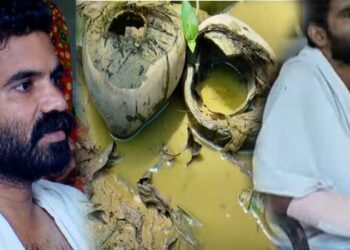 കുളം വൃത്തിയാക്കുന്നതിനിടെ കയ്യിൽ മീൻ കൊത്തി, മുറിവിലൂടെ ബാക്ടീരിയ ശരീരത്തിലേക്ക്!! ജീവൻ രക്ഷിക്കാൻ യുവാവിന്റെ വലതു കൈപ്പത്തി മുറിച്ചുമാറ്റി, വില്ലനായത് ഗ്യാസ് ഗാൻഗ്രീൻ ബാക്ടീരിയ, മുറിവേറ്റ ഭാ​ഗം നീക്കം ചെയ്തില്ലെങ്കിൽ മരണം ഉറപ്പ്- ഡോക്ടർമാർ