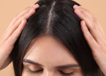 താരന്‍ അകറ്റാന്‍ അടുക്കളയിലുണ്ട് അഞ്ച് മാര്‍ഗങ്ങള്‍