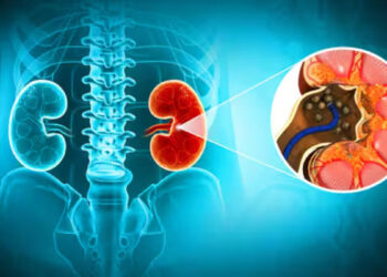 വൃക്കയിൽ കല്ലുകൾ ഉണ്ടെങ്കിൽ ഒഴിവാക്കേണ്ട എട്ട് ഭക്ഷണങ്ങൾ