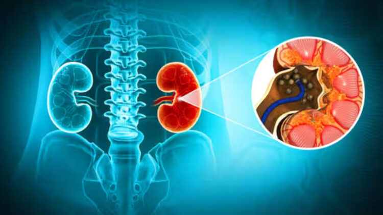 വൃക്കയിൽ കല്ലുകൾ ഉണ്ടെങ്കിൽ ഒഴിവാക്കേണ്ട എട്ട് ഭക്ഷണങ്ങൾ