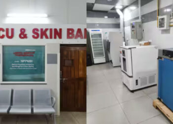 പൊള്ളലേറ്റ് എത്തുന്നവർക്ക് ആശ്വാസം; കേരളത്തിന് സ്വന്തമായി ആദ്യ ‘സ്‌കിൻ ബാങ്ക്’ തിരുവനന്തപുരം മെഡിക്കൽ കോളേജിൽ