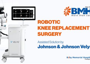 തൊടുപുഴ ബേബി മെമ്മോറിയൽ ഹോസ്പിറ്റലിൽ മുട്ടുമാറ്റിവയ്ക്കലിന് റോബോട്ടിക് സംവിധാനം; കേരളത്തിൽ ഇതാദ്യം; നേതൃത്വം വഹിക്കുക ഓർത്തോപീഡിക്സ് മേധാവി ഡോ. ഒ.ടി. ജോർജ്