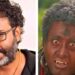 ആ ചെയ്തത് ഏറ്റവും വലിയ മണ്ടത്തരം!! എട്ട്- പത്ത് ദിവസം കഴിഞ്ഞപ്പോഴേക്കും കണ്ണിന് താഴെ പൊട്ടി, പഴുത്ത് ലിക്വിഡ് വരാൻ തുടങ്ങി”
