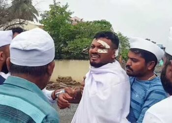 കൺമുന്നിൽ കത്തിയമർന്നത് കൂടപ്പിറപ്പ് ഉൾപ്പെടെ 241 ജീവനുകൾ, ഒന്നുറങ്ങാനാകാതെ വിശ്വാസ്, ‘അവൻ ആരോടും ഒന്നും സംസാരിക്കാറില്ല, ഉറക്കത്തിനിടെ അർധരാത്രി ഞെട്ടിയുണരുന്നത് പതിവ്!! മാനസികാരോഗ്യ വിദഗ്ധരുടെ സഹായത്തോടെയാണ് ഓരോദിവസവും തള്ളിനീക്കുന്നത്’- ബന്ധു