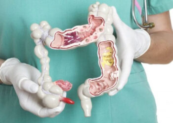 വൻകുടൽ ക്യാൻസറിന്റെ പ്രധാനപ്പെട്ട ലക്ഷണങ്ങൾ