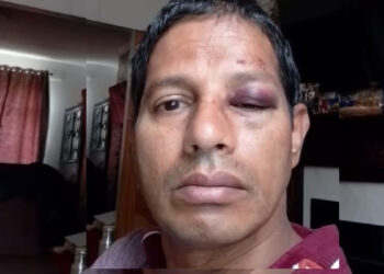 ഇന്ത്യൻ വംശജരുടെ ഭീതിയൊഴിയുന്നില്ല; ആറ് വയസുകാരിക്ക് പിന്നാലെ 51കാരനും അയർലണ്ടിൽ ക്രൂര മർദ്ദനം