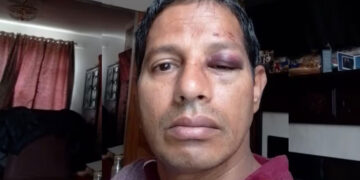 ഇന്ത്യൻ വംശജരുടെ ഭീതിയൊഴിയുന്നില്ല; ആറ് വയസുകാരിക്ക് പിന്നാലെ 51കാരനും അയർലണ്ടിൽ ക്രൂര മർദ്ദനം