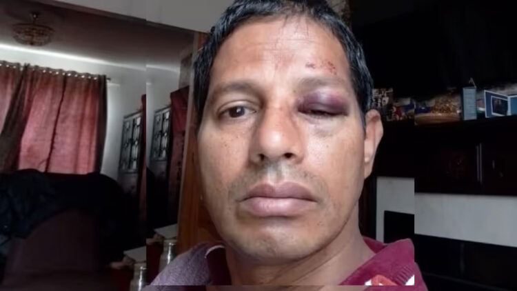 ഇന്ത്യൻ വംശജരുടെ ഭീതിയൊഴിയുന്നില്ല; ആറ് വയസുകാരിക്ക് പിന്നാലെ 51കാരനും അയർലണ്ടിൽ ക്രൂര മർദ്ദനം