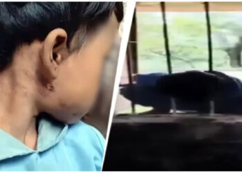 ഒരു രാത്രി മുഴുവൻ സ്കൂളിനുള്ളിൽ കുടുങ്ങി രണ്ടാം ക്ലാസുകാരി; ഗ്രില്ലിനിടയിൽ തല കുടുങ്ങി പരിക്ക്, പ്രതിഷേധം