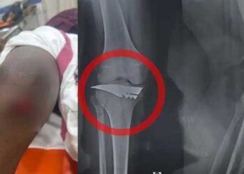 വിദ്യാർത്ഥിനിയെ ശല്യം ചെയ്തത് ചോദ്യം ചെയ്ത എസ്എഫ്ഐ പ്രവർത്തകന് കുത്തേറ്റു, ആയുധത്തിൻറെ ഒരു ഭാഗം കാലിൽ തറച്ചുകയറിയ വൈഷ്ണവിനെ ശസ്ത്രക്രിയയ്ക്ക് വിധേയനാക്കി, പിന്നിൽ സംഘമെന്ന് സൂചന