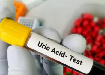 ശരീരത്തിൽ യൂറിക് ആസിഡിന്റെ അളവ് കൂടിയാൽ പ്രകടമാകുന്ന ലക്ഷണങ്ങൾ