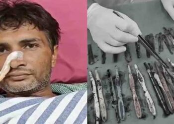 ലഹരിക്കടിമയായതോടെ ഡി അഡിക്ഷൻ കേന്ദ്രലെത്തിച്ചു, കഴിക്കാൻ കിട്ടുന്ന ഭക്ഷണം കൊണ്ട് വിശപ്പ് മാറുന്നില്ല, യുവാവ് അകത്താക്കിയത് 29 സ്റ്റീൽ സ്പൂണുകൾ, 19 ടൂത്ത് ബ്രഷുകൾ, രണ്ട് പേനകൾ.