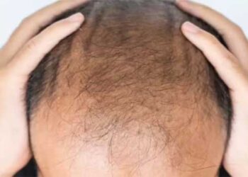 മുടി കൊഴിച്ചിൽ ഇനി ഒരു പ്രശ്നമേയല്ല, വെറും 20 ദിവസങ്ങൾക്കകം മുടി വളർത്താൻ കഴിയുന്ന പുതിയ സിറം വികസിപ്പിച്ചതായി തായ്‍വാൻ സർവകലാശാലയിലെ ഗവേഷകർ