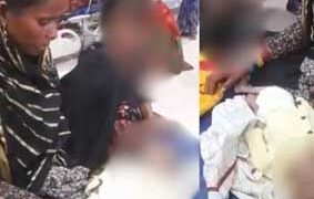 കുഴിഞ്ഞ കണ്ണുകൾ, ദുർബലമായ ചർമ്മം; മധ്യപ്രദേശിൽ പോഷകാഹാരക്കുറവ് മൂലം ഒരു ശിശു മരണം കൂടി