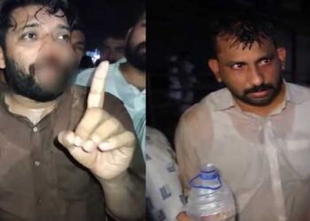 എൽഡിഎഫ്- യുഡിഎഫ് റാലിക്കിടെ മർ​ദനം, ഷാഫി പറമ്പിൽ എംപിയുടെ മുഖത്ത് പരുക്ക്, പോലീസ് നടത്തിയ കണ്ണീർ വാതക പ്രയോഗത്തിനിടെ ശ്വാസതടസം, ലാത്തിചാർജിൽ ഡിസിസി പ്രസിഡന്റ് ഉൾപ്പെടെയുള്ള യുഡിഎഫ് നേതാക്കൾക്കും പരുക്ക്