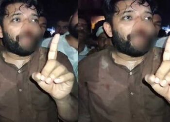 ‘പോലീസേ, ശമ്പളം പാർട്ടി ഓഫീസിൽ നിന്നല്ല തരുന്നത് എന്ന ഓർമ്മ വേണം, ഇപ്പോൾ ചെയ്ത പണിക്കുളള മറുപടി ഞങ്ങൾ തന്നിരിക്കും, ഈ മർദനത്തിനും ചോരയ്ക്കും പിന്നിലെ കാരണം സ്വർണക്കടത്ത് ഒളിച്ചുവയ്ക്കാനുളള വ്യാമോഹമാണെങ്കിൽ വെറുതെയാണ്- ഷാഫി!! ബ്ലോക്ക് തലങ്ങളിൽ നാളെ പ്രതിഷേധ പ്രകടനം