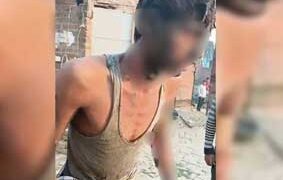 പള്ളിയിലെ പ്രാർത്ഥനയെച്ചൊല്ലിയുള്ള തർക്കം; യുപിയിൽ യുവാവിനെ തൂണിൽ കെട്ടി തീ കൊളുത്തി