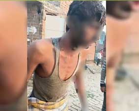 പള്ളിയിലെ പ്രാർത്ഥനയെച്ചൊല്ലിയുള്ള തർക്കം; യുപിയിൽ യുവാവിനെ തൂണിൽ കെട്ടി തീ കൊളുത്തി