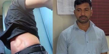 തലേദിവസം കുപ്പിവെള്ളം വാങ്ങി നോട്ട് കൊടുത്തതിൽ തർക്കം, പിറ്റേന്ന് പാൻട്രികാറിനകത്ത് മറന്നു വച്ച കണ്ണടയും തൊപ്പിയുമെടുക്കാനെത്തിയ യാത്രികന്റെ ​ദേഹത്ത് തിളച്ച വെള്ളം കോരിയൊഴിച്ചു, പാൻട്രികാർ ജീവനക്കാരൻ അറസ്റ്റിൽ