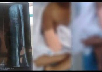 ‘സർക്കാരിൽ നിന്ന് നീതി കിട്ടിയില്ല, ആരും തിരിഞ്ഞുപോലും നോക്കിയില്ല’!! 9 വയസുകാരിയുടെ കൈ മുറിച്ചുമാറ്റിയ സംഭവത്തിൽ ഡോക്ടർമാർക്കെതിരെ നടപടി ആവശ്യപ്പെട്ട് പോലീസിൽ പരാതി നൽകി കുടുംബം