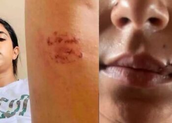 അയാൾ എന്റെ വയറ്റിൽ ചവിട്ടി, മുഖത്ത് ഇടിച്ചു, തല തറയിൽ ആഞ്ഞടിച്ചു, എന്റെ കക്ഷത്തും തുടകളിലും കടിച്ചു, ലോഹവള കൊണ്ട് എന്റെ മുഖത്ത് ശക്തിയായി അടിച്ചു, അടികൊണ്ട എന്റെ മേൽചുണ്ട് കീറിപ്പോയി…എന്നെ ആശുപത്രിയിൽ കൊണ്ടുപോകാൻ അയാളോട് യാചിച്ചു, പക്ഷേ അയാൾ വിസമ്മതിച്ചു- പങ്കാളിയിൽ നിന്നു നേരിട്ട ക്രൂര പീഡനം വെളിപ്പെടുത്തി നടി ജസീല