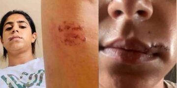 അയാൾ എന്റെ വയറ്റിൽ ചവിട്ടി, മുഖത്ത് ഇടിച്ചു, തല തറയിൽ ആഞ്ഞടിച്ചു, എന്റെ കക്ഷത്തും തുടകളിലും കടിച്ചു, ലോഹവള കൊണ്ട് എന്റെ മുഖത്ത് ശക്തിയായി അടിച്ചു, അടികൊണ്ട എന്റെ മേൽചുണ്ട് കീറിപ്പോയി…എന്നെ ആശുപത്രിയിൽ കൊണ്ടുപോകാൻ അയാളോട് യാചിച്ചു, പക്ഷേ അയാൾ വിസമ്മതിച്ചു- പങ്കാളിയിൽ നിന്നു നേരിട്ട ക്രൂര പീഡനം വെളിപ്പെടുത്തി നടി ജസീല