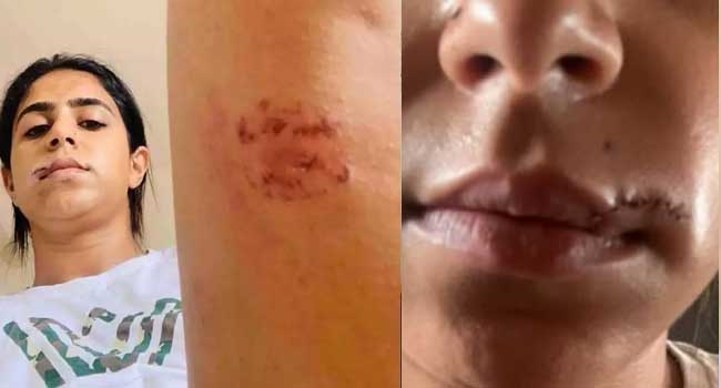 അയാൾ എന്റെ വയറ്റിൽ ചവിട്ടി, മുഖത്ത് ഇടിച്ചു, തല തറയിൽ ആഞ്ഞടിച്ചു, എന്റെ കക്ഷത്തും തുടകളിലും കടിച്ചു, ലോഹവള കൊണ്ട് എന്റെ മുഖത്ത് ശക്തിയായി അടിച്ചു, അടികൊണ്ട എന്റെ മേൽചുണ്ട് കീറിപ്പോയി…എന്നെ ആശുപത്രിയിൽ കൊണ്ടുപോകാൻ അയാളോട് യാചിച്ചു, പക്ഷേ അയാൾ വിസമ്മതിച്ചു- പങ്കാളിയിൽ നിന്നു നേരിട്ട ക്രൂര പീഡനം വെളിപ്പെടുത്തി നടി ജസീല