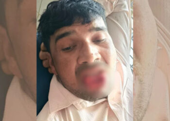 കുളക്കടവിലേക്ക് പോയ മുന്‍ കാമുകിയെ പിന്തുടര്‍ന്ന് ചുംബിക്കാന്‍ ശ്രമിച്ചു,  യുവാവിന്റെ നാവ് കടിച്ചുമുറിച്ച് യുവതി, രക്തം വാര്‍ന്നൊഴുകി 35കാരന്‍ ചികിത്സയില്‍