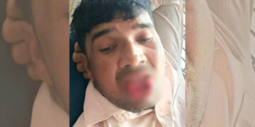 കുളക്കടവിലേക്ക് പോയ മുന്‍ കാമുകിയെ പിന്തുടര്‍ന്ന് ചുംബിക്കാന്‍ ശ്രമിച്ചു,  യുവാവിന്റെ നാവ് കടിച്ചുമുറിച്ച് യുവതി, രക്തം വാര്‍ന്നൊഴുകി 35കാരന്‍ ചികിത്സയില്‍