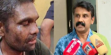 ‘മർദനമേറ്റിട്ടും കുറച്ച് സമയം അയാൾ ജീവനോടെ ഉണ്ടായിരുന്നു, പക്ഷെ ആ മരണം അതിദാരുണമായിരുന്നു… അടി കിട്ടാത്ത ഒരു ഭാ​ഗം പോലും ആ ശരീരത്തിലുണ്ടായിരുന്നില്ല, പലയിടങ്ങളിൽ ഉണ്ടായ മുറിവിൽ നിന്ന് രക്തം വാർന്നാണ് യുവാവ് മരിച്ചത്!! അതിഥി തൊഴിലാളികളെന്ന് നമ്മൾ വിളിക്കുന്നവരുടെ കൂട്ടത്തിലുള്ള ഒരാളെയാണ് മൃഗത്തെ പോലെ തല്ലിക്കൊന്നത്’- രാം നാരായണന്റെ പോസ്റ്റ്‌മോർട്ടം നടത്തിയ ഫോറൻസിക് സർജൻ