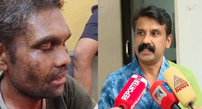 ‘മർദനമേറ്റിട്ടും കുറച്ച് സമയം അയാൾ ജീവനോടെ ഉണ്ടായിരുന്നു, പക്ഷെ ആ മരണം അതിദാരുണമായിരുന്നു… അടി കിട്ടാത്ത ഒരു ഭാ​ഗം പോലും ആ ശരീരത്തിലുണ്ടായിരുന്നില്ല, പലയിടങ്ങളിൽ ഉണ്ടായ മുറിവിൽ നിന്ന് രക്തം വാർന്നാണ് യുവാവ് മരിച്ചത്!! അതിഥി തൊഴിലാളികളെന്ന് നമ്മൾ വിളിക്കുന്നവരുടെ കൂട്ടത്തിലുള്ള ഒരാളെയാണ് മൃഗത്തെ പോലെ തല്ലിക്കൊന്നത്’- രാം നാരായണന്റെ പോസ്റ്റ്‌മോർട്ടം നടത്തിയ ഫോറൻസിക് സർജൻ