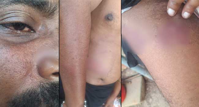 കാപ്പാ കേസിലടക്കം പ്രതിയായ പിഎസ് ശരത്തെന്നു കരുതി പോലീസ് കസ്റ്റഡിയിലെടുത്തത് നിരപരാധിയായ മറ്റൊരു ശരത്തിനെ!! രാത്രി വീട്ടിൽ കയറിവന്ന പോലീസ് യുവാവിനെ തലങ്ങും വിലങ്ങും മർദിച്ചു, ലാത്തികൊണ്ട് വയറ്റിലും പുറത്തും അടിയും കുത്തും, ഉന്തിത്തള്ളി ജീപ്പിൽ കയറ്റുന്നതിനിടെ തലയിടിച്ച് പരുക്ക്