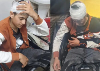 മുസ്ലിം വേട്ട തുടര്‍ന്ന് ബിജെപി, ഷാള്‍ വില്‍ക്കാനെത്തിയ 18 കാരനെ ക്രൂരമായി മര്‍ദിച്ച് ഹിന്ദുത്വ പ്രവര്‍ത്തകര്‍, ഇരുമ്പുകമ്പി കൊണ്ട് തലയടിച്ചുപൊട്ടിച്ചു, ഇടത് കൈ അടിച്ചൊടിച്ചു, രക്തം വാര്‍ന്നൊഴുകിയ യുവാവ് ഗുരുതര പരിക്കുകളുമായി ആശുപത്രിയില്‍