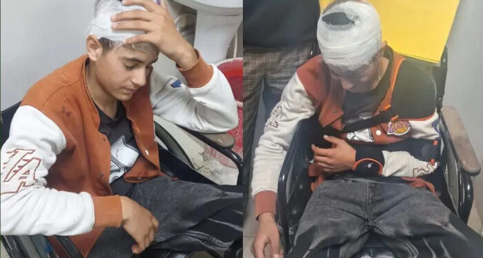 മുസ്ലിം വേട്ട തുടര്ന്ന് ബിജെപി, ഷാള് വില്ക്കാനെത്തിയ 18 കാരനെ ക്രൂരമായി മര്ദിച്ച് ഹിന്ദുത്വ പ്രവര്ത്തകര്, ഇരുമ്പുകമ്പി കൊണ്ട് തലയടിച്ചുപൊട്ടിച്ചു, ഇടത് കൈ അടിച്ചൊടിച്ചു, രക്തം വാര്ന്നൊഴുകിയ യുവാവ് ഗുരുതര പരിക്കുകളുമായി ആശുപത്രിയില്