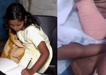 അവൾ എഴുതി പഠിക്കുവാണ് ഇടതു കൈകൊണ്ട്, ഡോക്ടറുടെ അനാസ്ഥയിൽ വലതു കൈ നഷ്ടപ്പെട്ട കുഞ്ഞു വിനോദിനിക്ക് പുതുവർഷത്തിലും സ്കൂളിൽ പോകാനായിട്ടില്ല, മുറുച്ചുമാറ്റിയ വലതു കൈയ്ക്ക് പകരം കൃത്രിമ കൈ വയ്ക്കാൻ സർക്കാർ പ്രഖ്യാപിച്ച 2 ലക്ഷം അപര്യാപ്തം, മറ്റു സാമ്പത്തികമില്ല… കലക്ടറെ കണ്ട് പരാതി അറിയിച്ചിട്ടുണ്ടെന്ന് കുടുംബം