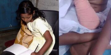 അവൾ എഴുതി പഠിക്കുവാണ് ഇടതു കൈകൊണ്ട്, ഡോക്ടറുടെ അനാസ്ഥയിൽ വലതു കൈ നഷ്ടപ്പെട്ട കുഞ്ഞു വിനോദിനിക്ക് പുതുവർഷത്തിലും സ്കൂളിൽ പോകാനായിട്ടില്ല, മുറുച്ചുമാറ്റിയ വലതു കൈയ്ക്ക് പകരം കൃത്രിമ കൈ വയ്ക്കാൻ സർക്കാർ പ്രഖ്യാപിച്ച 2 ലക്ഷം അപര്യാപ്തം, മറ്റു സാമ്പത്തികമില്ല… കലക്ടറെ കണ്ട് പരാതി അറിയിച്ചിട്ടുണ്ടെന്ന് കുടുംബം