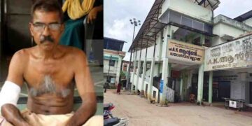 മറവി കൂടുന്നു… ആലപ്പുഴയിൽ മറന്നുവച്ചത് കത്രിക, ചേർത്തലയിൽ കുപ്പിച്ചില്ല്!! വാഹനാപകടത്തിൽ കയ്യിൽ തറച്ച ചില്ല് മാറ്റാതെ മുറിവ് തുന്നിക്കെട്ടി… സംഭവം ചേർത്തല താലൂക്ക് ആശുപത്രിയിൽ, കയ്യിൽ നിരന്തരം വേദന വന്നതോടെ സ്വകാര്യ ആശുപത്രിയിൽ ചികിത്സ തേടി….