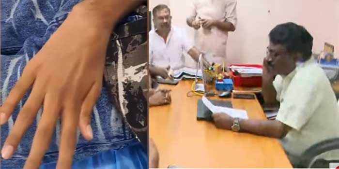 ‘കുട്ടിയുടെ കൈ വളഞ്ഞതൊക്കെ പരിഹരിക്കാൻ പറ്റുന്ന കാര്യമേയുള്ളൂ സുഹൃത്തേ, അതു സ്വാഭാവികമാണ്, അംഗീകരിക്കണം’… ശസ്ത്രക്രിയയ്ക്കിടെ 14 കാരന്റെ കൈ വളഞ്ഞുപോയത് ലാഘവത്തോടെ പ്രതിഷേധക്കാർക്കുമുൻപിൽ വിളമ്പി ആശുപത്രി സൂപ്രണ്ട്