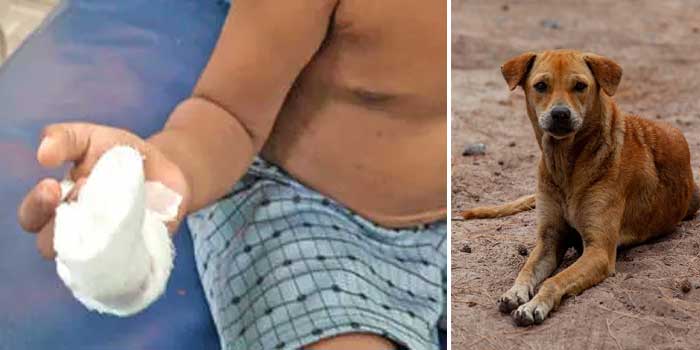 വരാന്തയിൽ മുത്തശ്ശനും മുത്തശ്ശിക്കുമൊപ്പം കളിച്ചുകൊണ്ടിരിക്കെ മുറ്റത്തേക്കിറങ്ങിയ മൂന്നു വയസുകാരന്റെ ചെറുവിരൽ തെരുവുനായ കടിച്ചുപറിച്ചെടുത്തു, അലറിക്കരച്ചിൽ കേട്ട് ഓടിയെത്തിയപ്പോൾ കണ്ടത് രക്തംവാർന്ന കൈയുമായി നിൽക്കുന്ന കുഞ്ഞിനെ