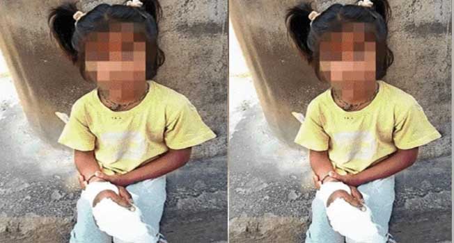 സ്കൂളിലെ ഇരുമ്പുവാതിലിൽ കുടുങ്ങി ഒന്നാംക്ലാസുകാരിയുടെ രണ്ട് കൈവിരലുകൾ അറ്റു, മുറിഞ്ഞുപോയ വിരലുകൾ തൂത്തുവാരി മാലിന്യക്കുട്ടിയിലേക്കെറിഞ്ഞ് സ്കൂൾ അധികൃതർ… കുട്ടിയെ ആശുപത്രിയിലെത്തിച്ചത് രക്ഷിതാക്കൾ വന്നശേഷം, വിരലുകൾ തുന്നിച്ചേർക്കാനാവില്ലെന്ന് ഡോക്ടർമാർ!! രക്ഷിതാക്കളുടെ പരാതിയിൽ മൂന്നുപേർക്കെതിരെ കേസ്