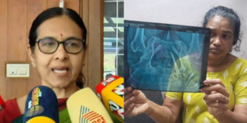 ഉഷയ്ക്ക് മുമ്പും ശസ്ത്രക്രിയ നടന്നിട്ടുണ്ട്, ഉപകരണം 20 വര്‍ഷം മുൻപ് നടന്ന സർജറിയിൽ കുടുങ്ങിയതാകാം, അവര്‍ക്ക് താന്‍ ശസ്ത്രക്രിയ നടത്തിയിട്ടില്ല, ഇതിനെല്ലാം കാരണം സിസ്റ്റത്തിന്റെ വീഴ്ചയെന്ന് ഡോം. ലളിതാംബിക