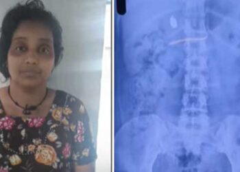 യുവതിക്ക് എനിമ വച്ച് തൊണ്ടിമുതലിനായുള്ള വനിതാ പോലീസിന്റെ കാത്തിരിപ്പ് മൂന്നാം ദിവസത്തിലേക്ക്…  ക്ലിനിക്കിലെത്തിയ കുട്ടിയു‌ടെ 3.5 ​ഗ്രാം വരുന്ന സ്വർണമാല അടിച്ചുമാറ്റി വിഴുങ്ങി, എടുത്തിട്ടില്ലെന്ന് യുവതി, എക്സറേയിൽ സ്വർണം വയറ്റിലുണ്ടെന്ന് കണ്ടെത്തൽ…’തൊണ്ടിമുതലും ദൃക്സാക്ഷിയു’മായി കേരളാ പോലീസും സമീനയും