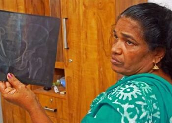 ‘സംഭവിച്ചത് ഗുരുതരമായ പിഴവ്…ശസ്ത്രക്രിയ ചെയ്തത് ഞാനാണോയെന്ന് ഓർമയില്ല, കേസ് ഷീറ്റിൽ എന്റെ പേരുണ്ടെങ്കിൽ ഞാൻ ആയിരിക്കും, കോവിഡ് കാലത്ത് ഒരേസമയം രണ്ട് തീയറ്ററിൽ പ്രവർത്തിക്കേണ്ട സാഹചര്യം ഉണ്ടായിട്ടുണ്ട്, എങ്കിലും മുറിവ് തുന്നിക്കെട്ടുന്നതിന് മുമ്പ് ഉപകരണങ്ങളും മറ്റും കൃത്യമാണോയെന്ന് സ്ക്രബ് നേഴ്സിനോട് രണ്ട് തവണ ചോദിച്ച് ഉറപ്പുവരുത്തുന്ന ശീലം തനിക്കുണ്ട്’- ഡോ. ഷാഹിദ