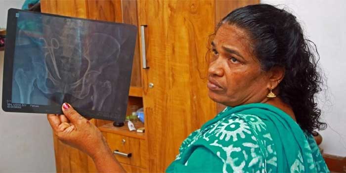 ‘സംഭവിച്ചത് ഗുരുതരമായ പിഴവ്…ശസ്ത്രക്രിയ ചെയ്തത് ഞാനാണോയെന്ന് ഓർമയില്ല, കേസ് ഷീറ്റിൽ എന്റെ പേരുണ്ടെങ്കിൽ ഞാൻ ആയിരിക്കും, കോവിഡ് കാലത്ത് ഒരേസമയം രണ്ട് തീയറ്ററിൽ പ്രവർത്തിക്കേണ്ട സാഹചര്യം ഉണ്ടായിട്ടുണ്ട്, എങ്കിലും മുറിവ് തുന്നിക്കെട്ടുന്നതിന് മുമ്പ് ഉപകരണങ്ങളും മറ്റും കൃത്യമാണോയെന്ന് സ്ക്രബ് നേഴ്സിനോട് രണ്ട് തവണ ചോദിച്ച് ഉറപ്പുവരുത്തുന്ന ശീലം തനിക്കുണ്ട്’- ഡോ. ഷാഹിദ