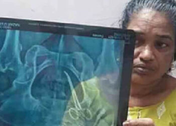 വണ്ടാനത്ത് അമ്മയെ കാണിച്ചതാണ് ഞങ്ങളുടെ തെറ്റ്, അത്രയധികം അനുഭവിച്ചു, ഞങ്ങൾ കത്രിക വിഴുങ്ങിയത് പോലെയാണ് അന്വേഷണ റിപ്പോര്ട്ട്, എല്ലാവരും കയ്യൊഴിഞ്ഞു, നീതിക്കായി ഏതറ്റം വരെയും പോകുമെന്ന് ഉഷയുടെ മകന്